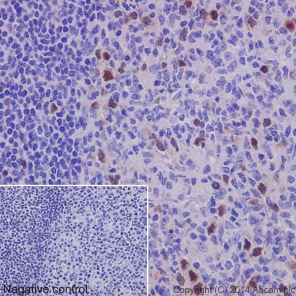 Immunohistochemistry (Formalin/PFA-fixed paraffin-embedded sections) - Anti-Geminin antibody [EPR14637] (AB195047), expandable thumbnail