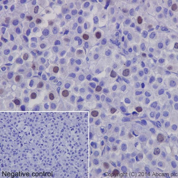 Immunohistochemistry (Formalin/PFA-fixed paraffin-embedded sections) - Anti-Geminin antibody [EPR14637] (AB195047), expandable thumbnail