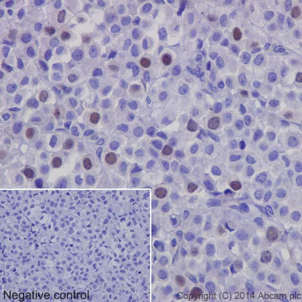 Immunohistochemistry (Formalin/PFA-fixed paraffin-embedded sections) - Anti-Geminin antibody [EPR14637] (AB195047)