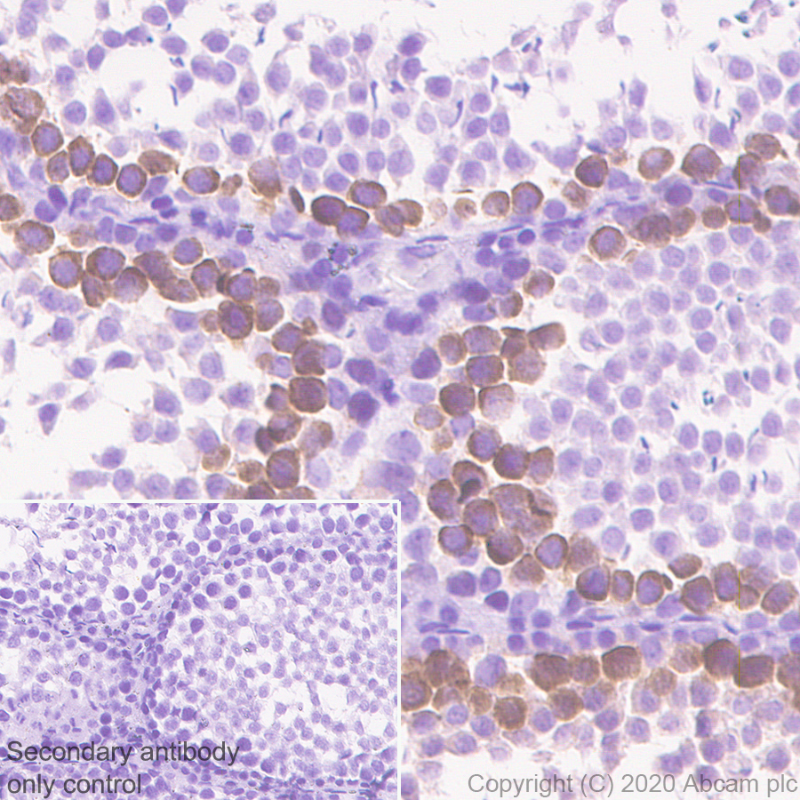 Immunohistochemistry (Formalin/PFA-fixed paraffin-embedded sections) - Anti-Geminin antibody [EPR23754-87] - BSA and Azide free (ab273633), expandable thumbnail