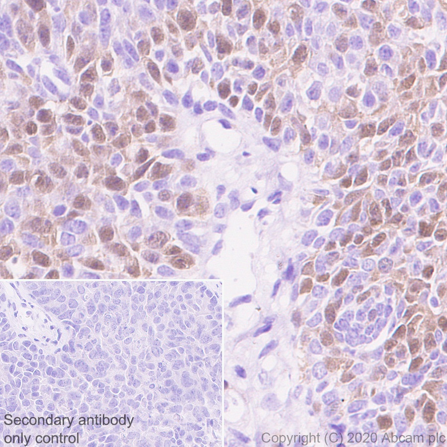Immunohistochemistry (Formalin/PFA-fixed paraffin-embedded sections) - Anti-Geminin antibody [EPR23754-87] - BSA and Azide free (AB273633), expandable thumbnail