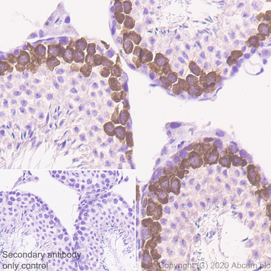 Immunohistochemistry (Formalin/PFA-fixed paraffin-embedded sections) - Anti-Geminin antibody [EPR23754-87] - BSA and Azide free (AB273633), expandable thumbnail