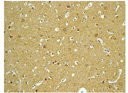 Immunohistochemistry (Formalin/PFA-fixed paraffin-embedded sections) - Anti-Gephyrin antibody [EPR12650] (AB181382)