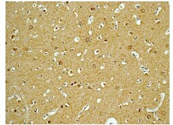 Immunohistochemistry (Formalin/PFA-fixed paraffin-embedded sections) - Anti-Gephyrin antibody [EPR12650] - BSA and Azide free (AB250503), expandable thumbnail