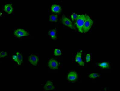 Immunocytochemistry/ Immunofluorescence - Anti-Germinal Center Kinase/GCK antibody (AB238843)