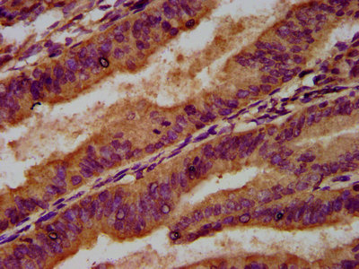 Immunohistochemistry (Formalin/PFA-fixed paraffin-embedded sections) - Anti-Germinal Center Kinase/GCK antibody (AB238843)