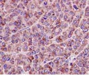 Immunohistochemistry (Formalin/PFA-fixed paraffin-embedded sections) - Anti-Germinal Center Kinase/GCK antibody [EPR14304] (AB184169)