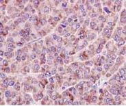 Immunohistochemistry (Formalin/PFA-fixed paraffin-embedded sections) - Anti-Germinal Center Kinase/GCK antibody [EPR14304] - BSA and Azide free (AB250726)