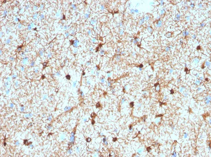 Immunohistochemistry (Formalin/PFA-fixed paraffin-embedded sections) - Anti-GFAP antibody [2076] - Astrocyte Marker (AB224659)