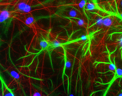 Immunocytochemistry/ Immunofluorescence - Anti-GFAP antibody [2A5] (AB4648), expandable thumbnail