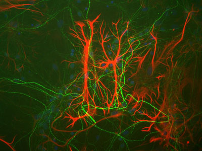 Immunocytochemistry/ Immunofluorescence - Anti-GFAP antibody [2A5] (ab4648), expandable thumbnail