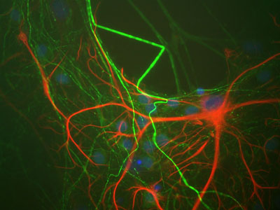 Immunocytochemistry/ Immunofluorescence - Anti-GFAP antibody [2A5] (ab4648), expandable thumbnail