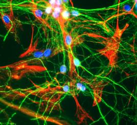 Immunocytochemistry/ Immunofluorescence - Anti-GFAP antibody [2A5] (AB4648), expandable thumbnail