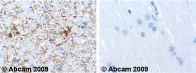 Immunohistochemistry (Formalin/PFA-fixed paraffin-embedded sections) - Anti-GFAP antibody [2A5] (AB4648), expandable thumbnail