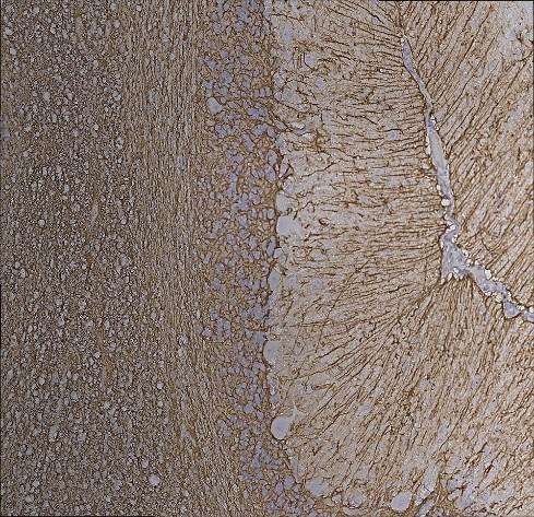 Immunohistochemistry (Formalin/PFA-fixed paraffin-embedded sections) - Anti-GFAP antibody [2A5] (ab4648), expandable thumbnail