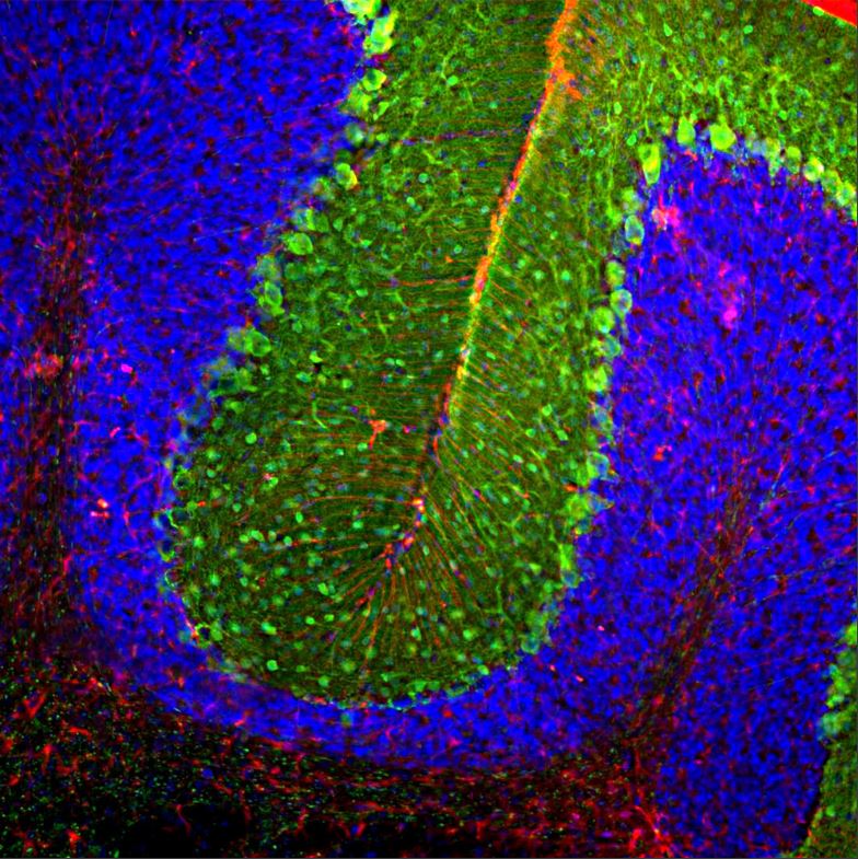 Immunohistochemistry - Free Floating - Anti-GFAP antibody [2A5] (AB4648), expandable thumbnail