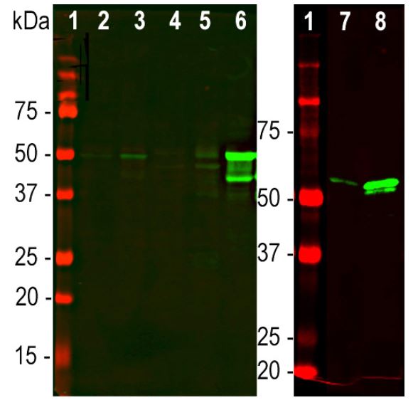Western blot - Anti-GFAP antibody [2A5] (AB4648), expandable thumbnail