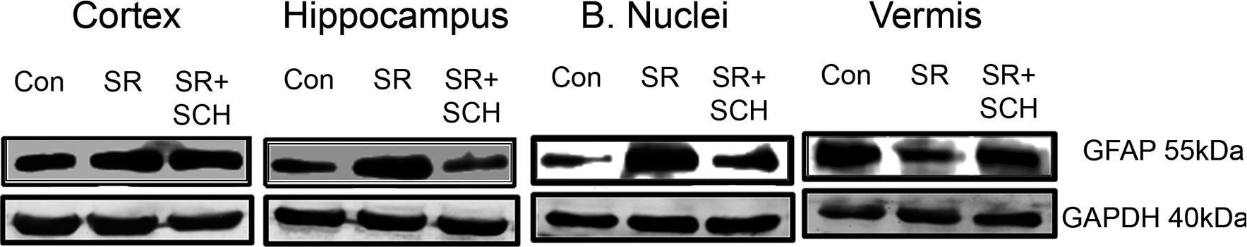 Western blot - Anti-GFAP antibody [2A5] (ab4648), expandable thumbnail
