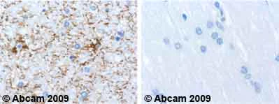 Immunohistochemistry (Formalin/PFA-fixed paraffin-embedded sections) - Anti-GFAP antibody [2A5] - Astrocyte Marker (AB4648)