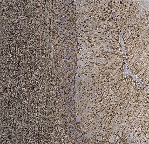 Immunohistochemistry (Formalin/PFA-fixed paraffin-embedded sections) - Anti-GFAP antibody [2A5] - Astrocyte Marker (AB4648)