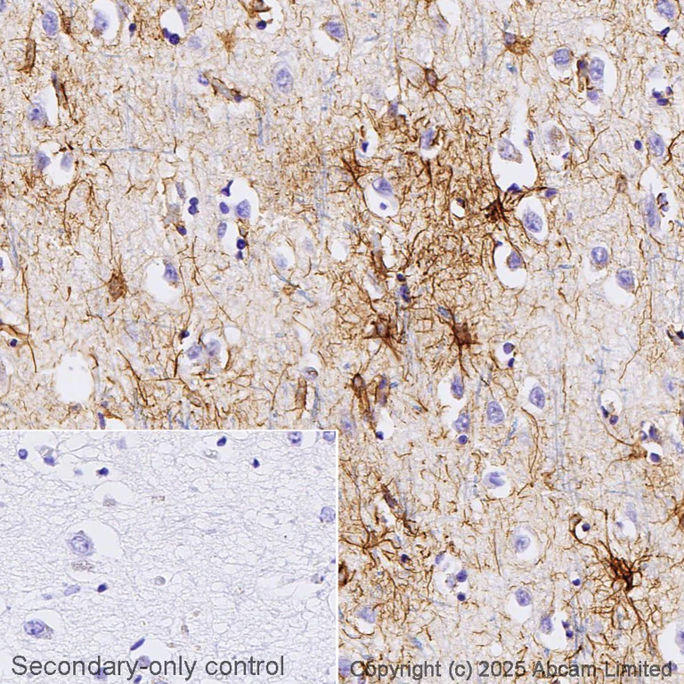 Immunohistochemistry (Formalin/PFA-fixed paraffin-embedded sections) - Anti-GFAP antibody [2A5] - Astrocyte Marker (AB4648)