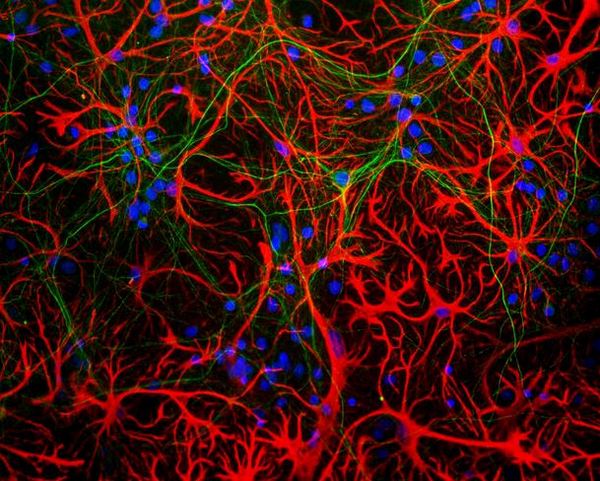 Immunocytochemistry/ Immunofluorescence - Anti-GFAP antibody [5C10] (AB190288), expandable thumbnail