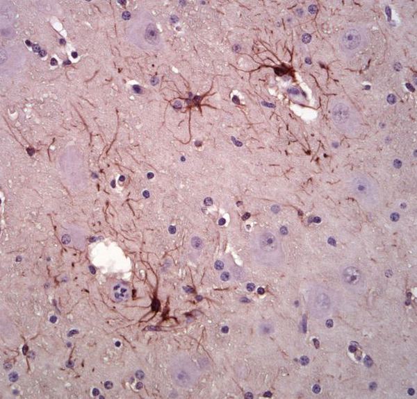 Immunohistochemistry (Formalin/PFA-fixed paraffin-embedded sections) - Anti-GFAP antibody [5C10] (AB190288), expandable thumbnail