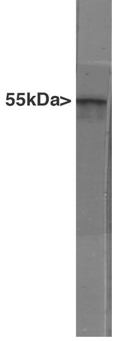 Western blot - Anti-GFAP antibody [5C10] (AB190288), expandable thumbnail