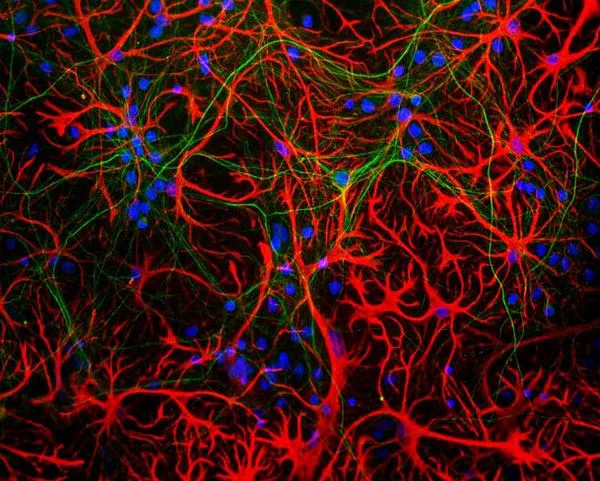 Immunocytochemistry/ Immunofluorescence - Anti-GFAP antibody [5C10] - Astrocyte Marker (AB190288)