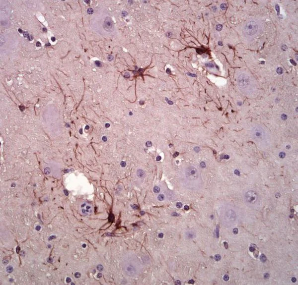 Immunohistochemistry (Formalin/PFA-fixed paraffin-embedded sections) - Anti-GFAP antibody [5C10] - Astrocyte Marker (AB190288)