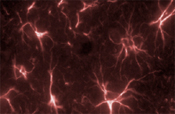 Immunocytochemistry/ Immunofluorescence - Anti-GFAP antibody (AB90601), expandable thumbnail