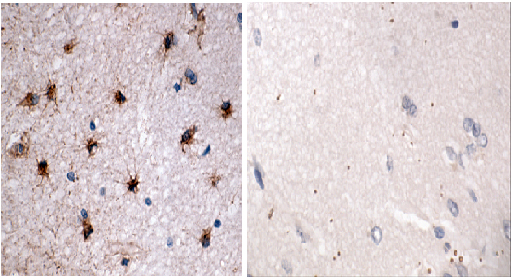 Immunohistochemistry (Formalin/PFA-fixed paraffin-embedded sections) - Anti-GFAP antibody (AB90601), expandable thumbnail