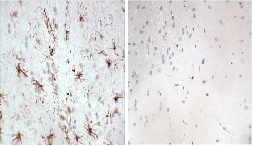 Immunohistochemistry (Formalin/PFA-fixed paraffin-embedded sections) - Anti-GFAP antibody (AB90601), expandable thumbnail