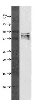 Western blot - Anti-GFAP antibody (AB90601), expandable thumbnail
