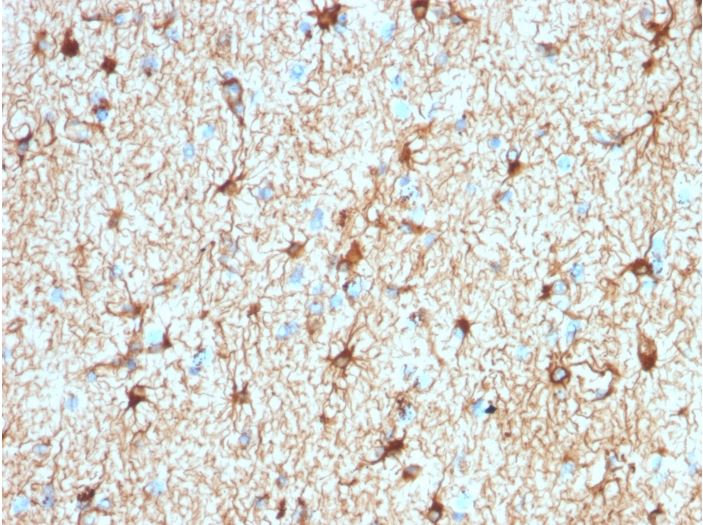 Immunohistochemistry (Formalin/PFA-fixed paraffin-embedded sections) - Anti-GFAP antibody [ASTRO/1974R] - Astrocyte Marker (AB270270), expandable thumbnail