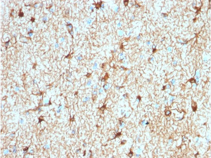 Immunohistochemistry (Formalin/PFA-fixed paraffin-embedded sections) - Anti-GFAP antibody [ASTRO/1974R] - Astrocyte Marker (AB270270)