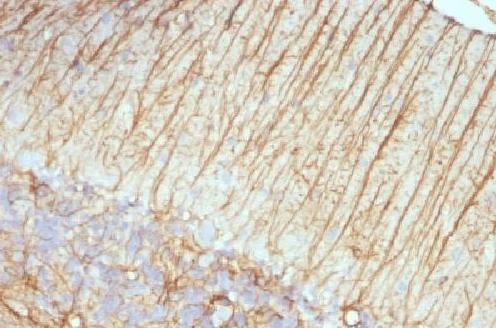 Immunohistochemistry (Formalin/PFA-fixed paraffin-embedded sections) - Anti-GFAP antibody [ASTRO/789] - BSA and Azide free (AB212401), expandable thumbnail