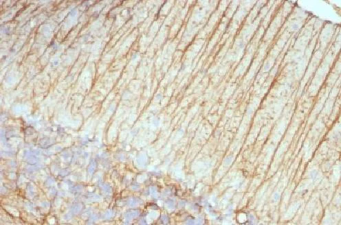 Immunohistochemistry (Formalin/PFA-fixed paraffin-embedded sections) - Anti-GFAP antibody [ASTRO/789] - BSA and Azide free (AB212401)