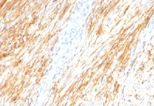 Immunohistochemistry (Formalin/PFA-fixed paraffin-embedded sections) - Anti-GFAP antibody [ASTRO/789] - BSA and Azide free (AB212401), expandable thumbnail