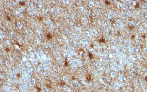 Immunohistochemistry (Formalin/PFA-fixed paraffin-embedded sections) - Anti-GFAP antibody [ASTRO/789] - BSA and Azide free (AB212401)