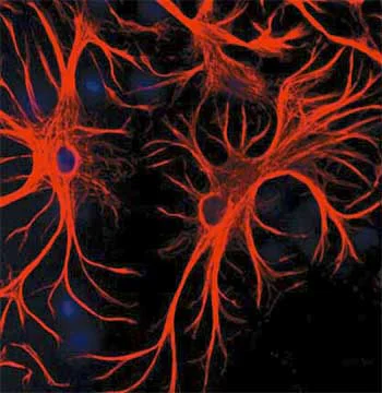 Immunocytochemistry/ Immunofluorescence - Anti-GFAP antibody - Astrocyte Marker (AB134436)