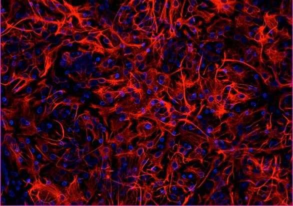Immunocytochemistry/ Immunofluorescence - Anti-GFAP antibody - Astrocyte Marker (AB134436)