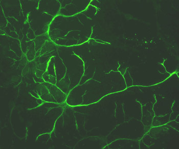 Immunocytochemistry - Anti-GFAP antibody - Astrocyte Marker (AB16997), expandable thumbnail