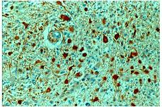 Immunohistochemistry (Formalin/PFA-fixed paraffin-embedded sections) - Anti-GFAP antibody - Astrocyte Marker (AB16997), expandable thumbnail