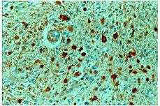 Immunohistochemistry (Formalin/PFA-fixed paraffin-embedded sections) - Anti-GFAP antibody - Astrocyte Marker (AB16997)