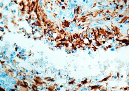 Immunohistochemistry (Formalin/PFA-fixed paraffin-embedded sections) - Anti-GFAP antibody - Astrocyte Marker (AB16997)