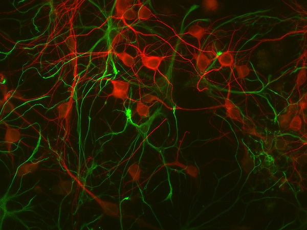 Immunocytochemistry/ Immunofluorescence - Anti-GFAP antibody (AB254082), expandable thumbnail