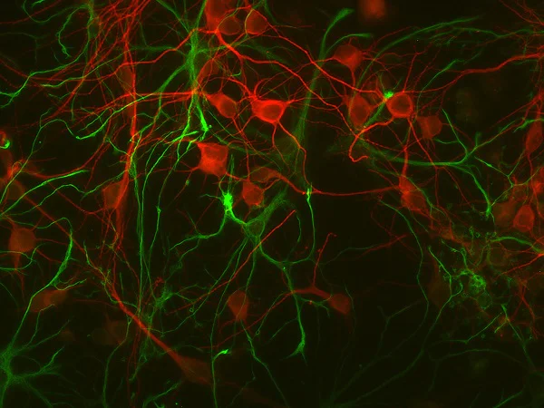 Immunocytochemistry/ Immunofluorescence - Anti-GFAP antibody - Astrocyte Marker (AB254082)