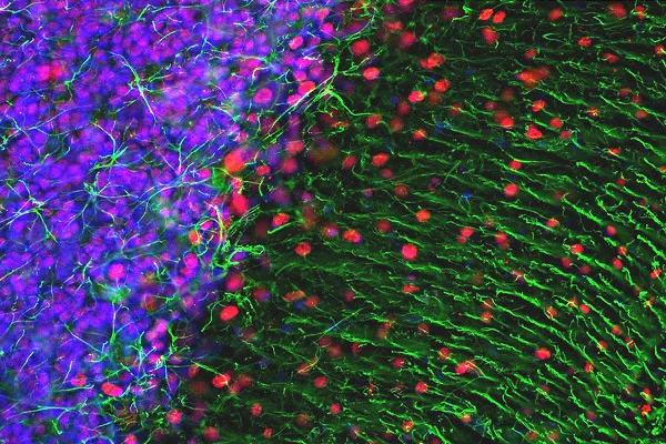Immunocytochemistry/ Immunofluorescence - Anti-GFAP antibody - Astrocyte Marker (AB254082)