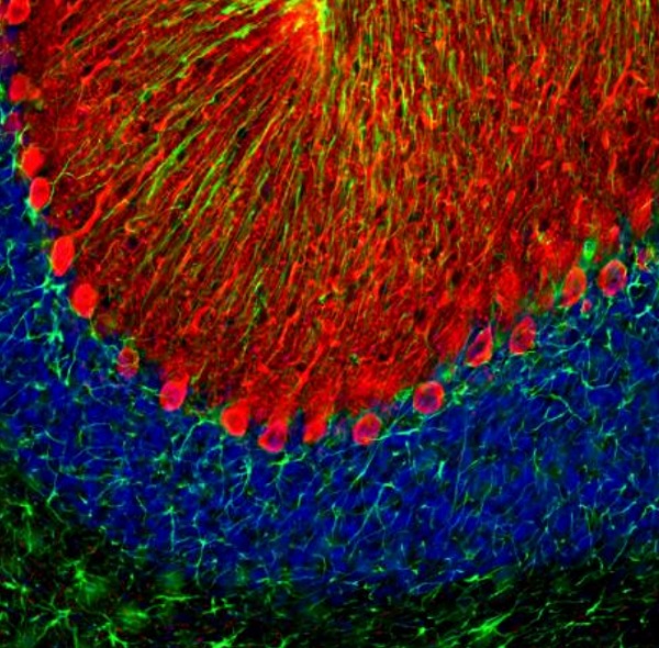 Immunocytochemistry/ Immunofluorescence - Anti-GFAP antibody (AB254082), expandable thumbnail